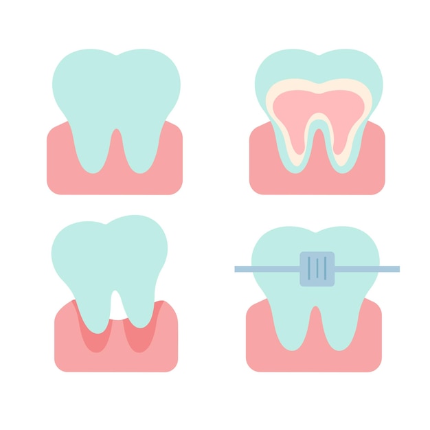 Vector ilustración plana vectorial de dientes en diferentes estados