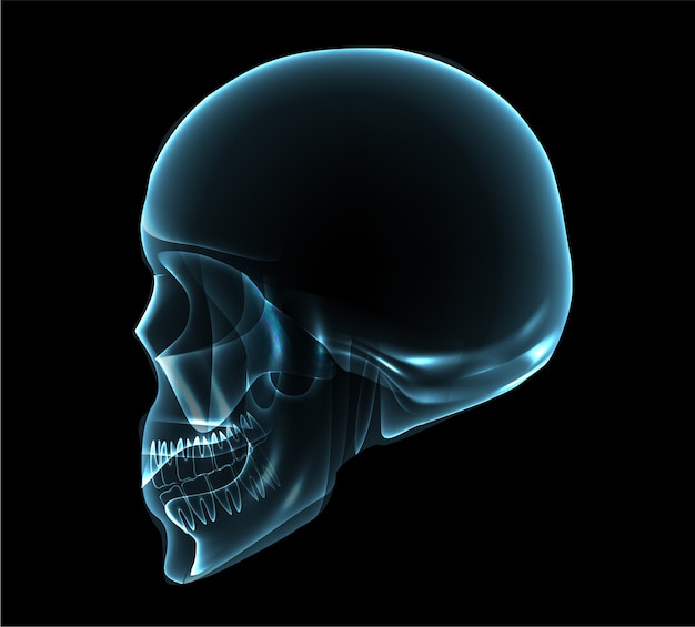 Vector ilustración de rayos x de vista lateral del cráneo humano
