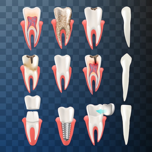 Ilustración realista set dientes diferente problema