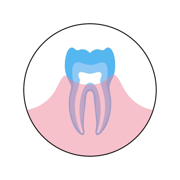Ilustración de vector de diente humano en infografías de anatomía de las encías. Ilustración de cartel médico
