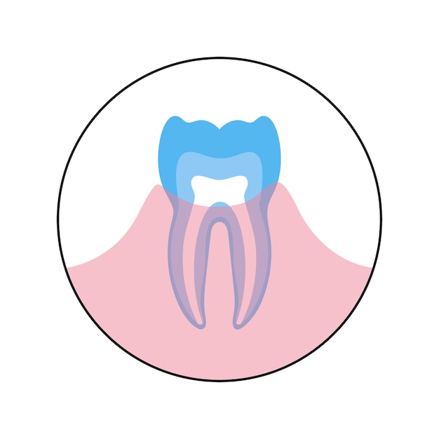 Ilustración de vector de diente humano en infografías de anatomía de las encías. Ilustración de cartel médico