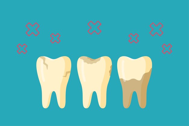 Ilustración de vector de dolor de muelas Tres dientes enfermos aislados sobre un fondo azul