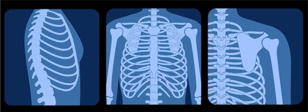 Ilustración de vector plano de anatomía de la caja torácica humana en el frente, perfil y espalda en vista de rayos x.