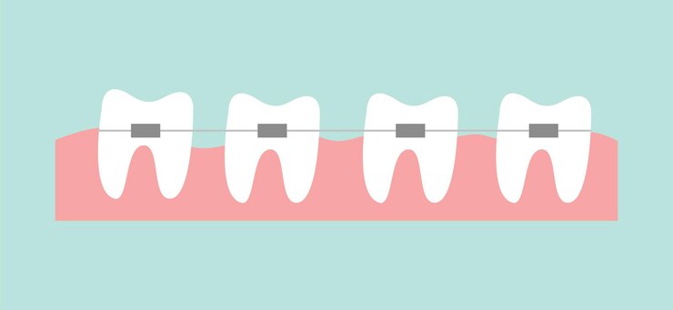 Vector ilustración de vector plano de dientes de frenos de dibujos animados