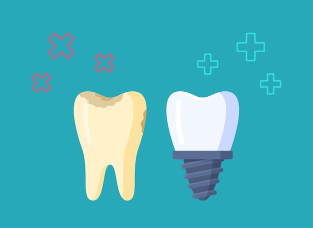 Ilustración de vector de tratamiento dental diente enfermo sucio y diente de prótesis sobre fondo azul