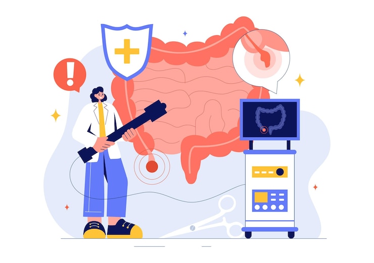 Vector ilustración vectorial de apendicitis con inflamación del apéndice y tratamiento del estómago en un fondo de dibujos animados de estilo plano de atención médica