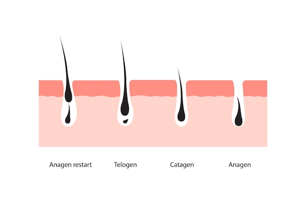 Vector ilustración vectorial de la piel del ciclo de crecimiento del cabello