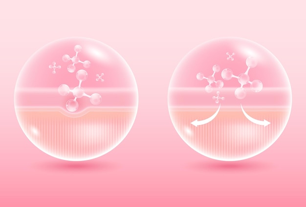 Ilustración vectorial de la piel sana y dañada Mejoradores de las capas cutáneas de la epidermis y la dermis