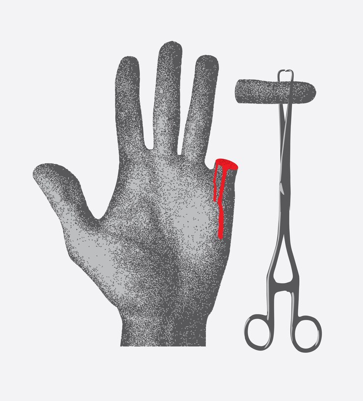 Vector imagen de la mano con el dedo en pinzas médicas