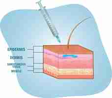 Vector imagen médica de hacer inyección en ilustración vectorial