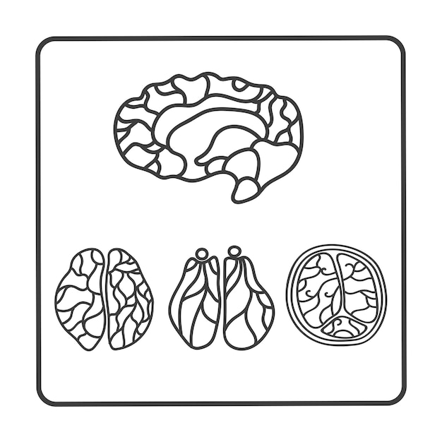 Vector imagen tomográfica del cerebro sección del hemisferio exploración diagnóstico investigación medicina cirugía