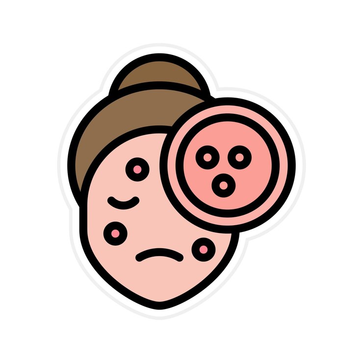 Vector imagen vectorial del icono del acné se puede usar para cosmetología