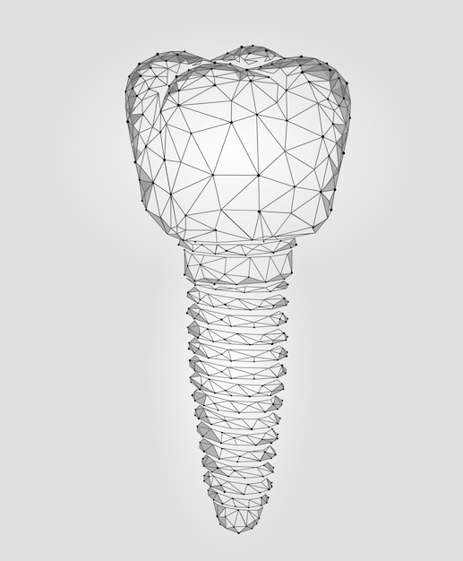 Vector implante dental de diente molar modelo geométrico 3d de baja poli. odontología innovación tecnología futura t