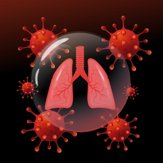 Infección por coronavirus de los pulmones