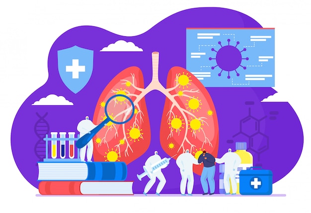 Vector infección por oronavirus cov en pulmones y médicos mini personas con ilustración plana paciente enfermo.