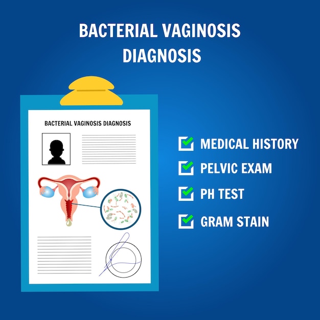 Vector infografía del diagnóstico de vaginosis bacteriana en ilustración vectorial