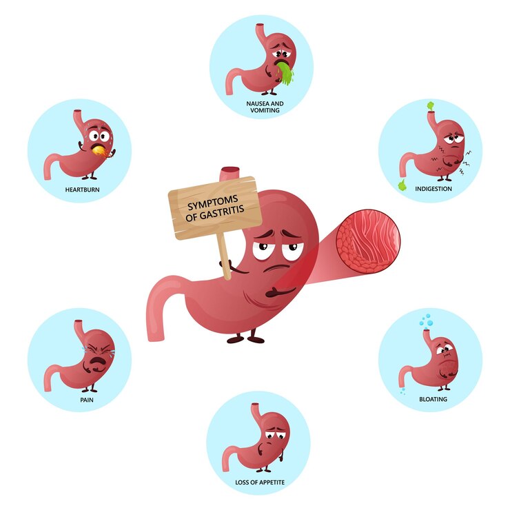 Vector infografía de síntomas de gastritis con personajes de dibujos animados de estómago