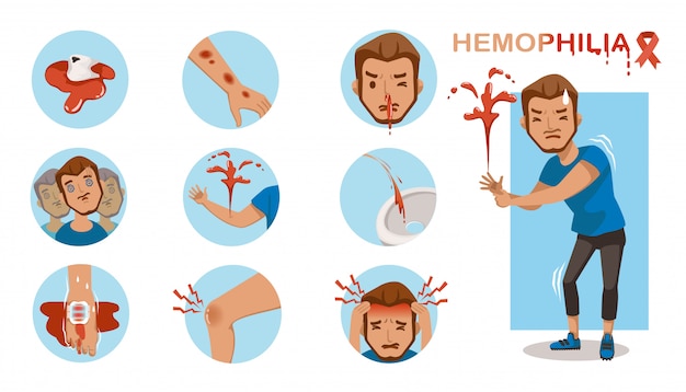 Infografía de síntomas de hemofilia en un círculo. sangrado excesivo.