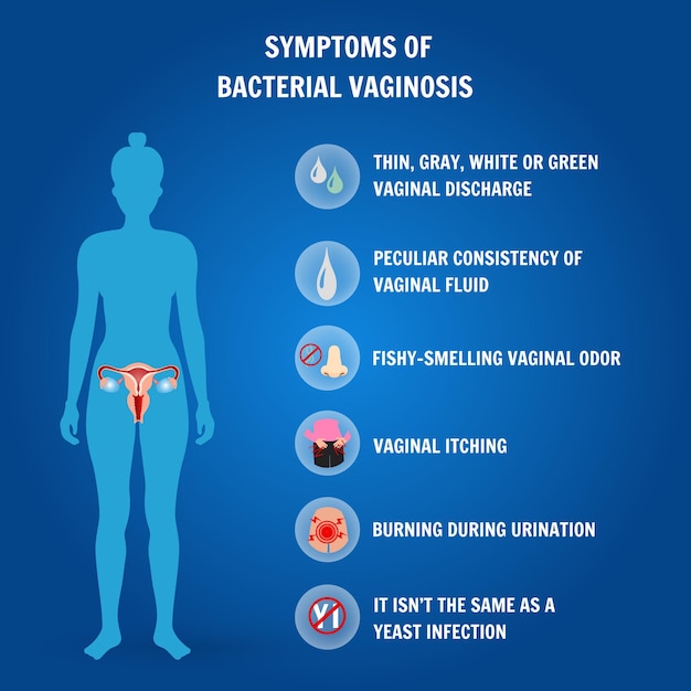 Vector infografía de los síntomas de la vaginosis bacteriana en la ilustración vectorial