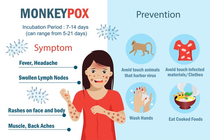 Vector infografía sobre los síntomas y la prevención del virus de la viruela del mono nuevo brote de ortopoxvirus en todo el mundo