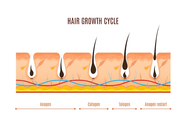 Infografías vectoriales de las fases del ciclo de crecimiento del cabello