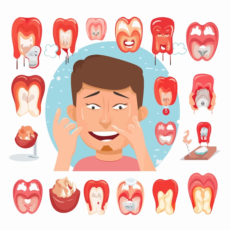 Vector infográfico de las etapas de la caries dental humana