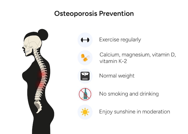 Información de advertencia médica de prevención de osteoporosis en vector