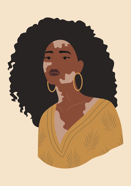 Joven mujer negra con cartel de vitíligo La belleza es diversidad