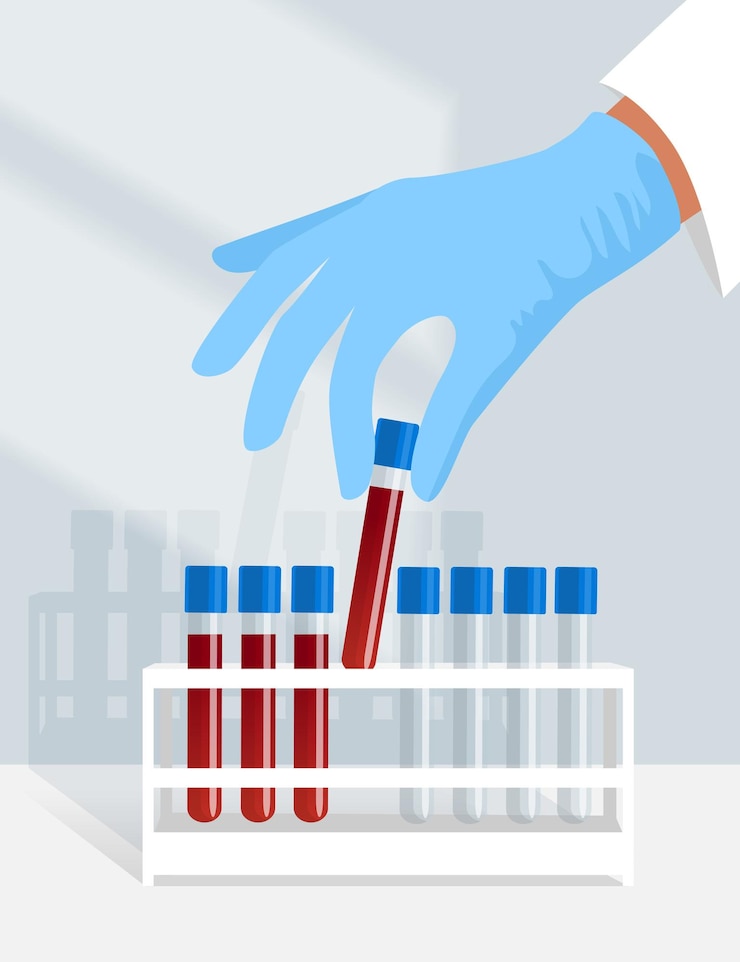 Vector a laboratory technician in a blue glove places a flask for analysis in a stand with other flasks