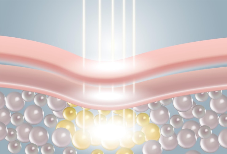 Vector láser a través de la capa de la piel suero o vitamina concepto de reparación de la piel células de la piel flácida renderización 3d
