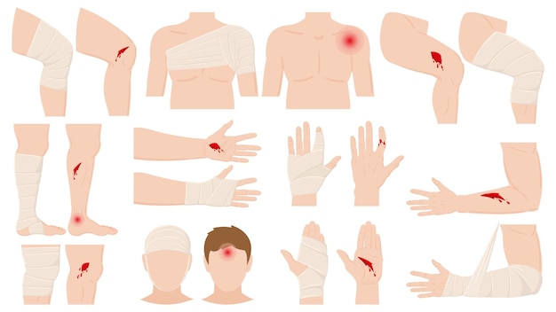 Lesión física de dibujos animados, aplicación de vendaje para heridas. Partes del cuerpo abiertas y vendadas, heridas tratadas, fracturas ilustración vectorial. Tratamiento de lesiones físicas humanas. Accidente físico de heridas y lesiones