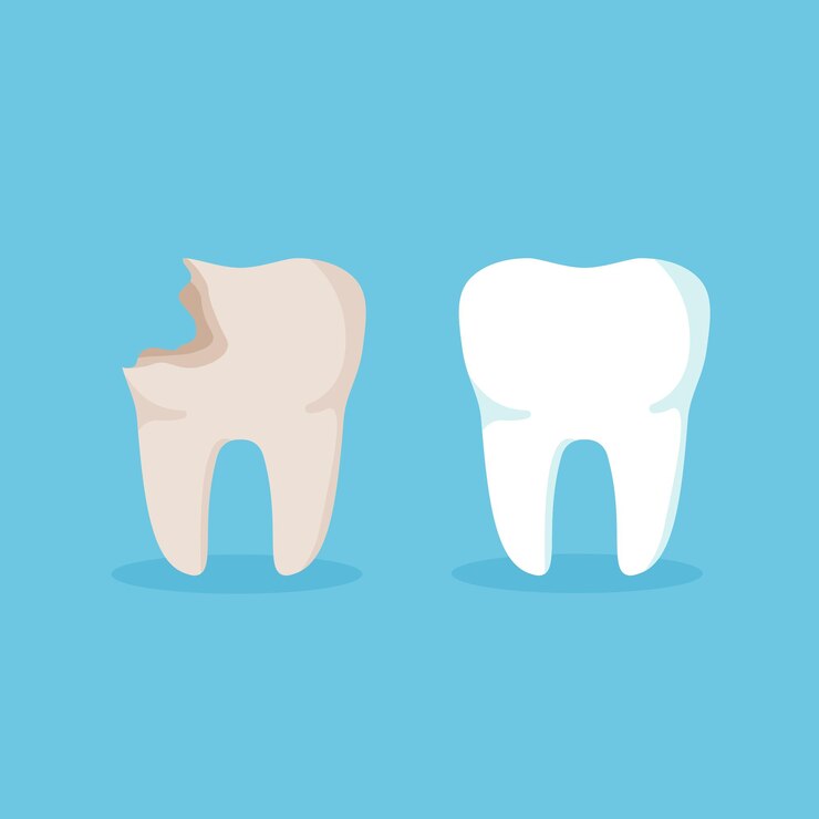 Vector limpieza de dientes. diente enfermo. antes y después del tratamiento de caries. concepto de salud dental. vector.