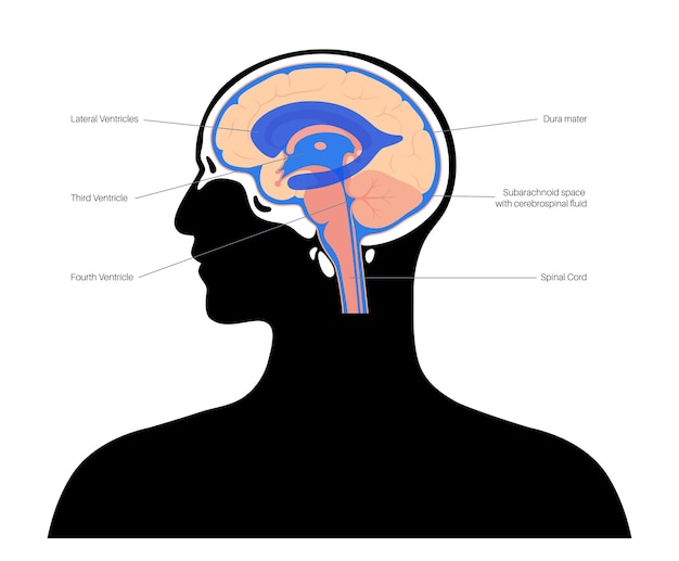 Líquidos cerebroespinales en el cerebro. anatomía del sistema ventricular. ilustración de vector de ventrículos cerebrales