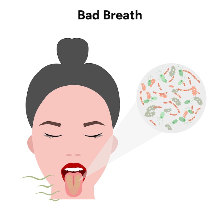 Vector mal aliento con bacterias en la boca halitosis