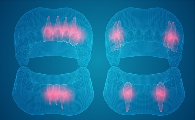 Mandíbula humana diseño 3d medicina y salud dolor de dientes