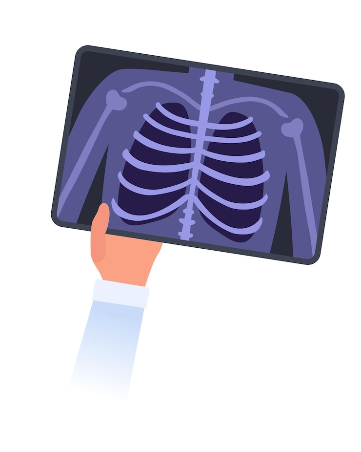 Vector la mano sostiene la imagen de rayos x de las costillas y los pulmones humanos concepto de fluorografía y radiografía examen médico
