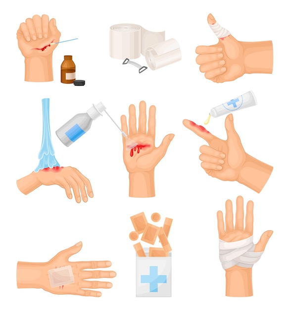 Manos con piel lesionada y procedimientos de vendaje y limpieza de heridas. Vector Set