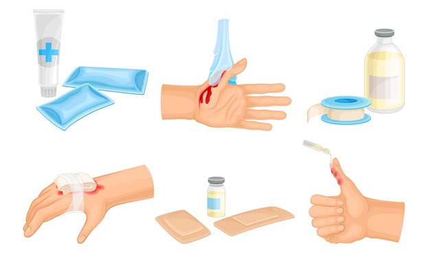 Manos con piel lesionada y procedimientos de vendaje y limpieza de heridas. Vector Set