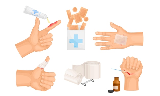 Manos con piel lesionada y procedimientos de vendaje y limpieza de heridas. Vector Set