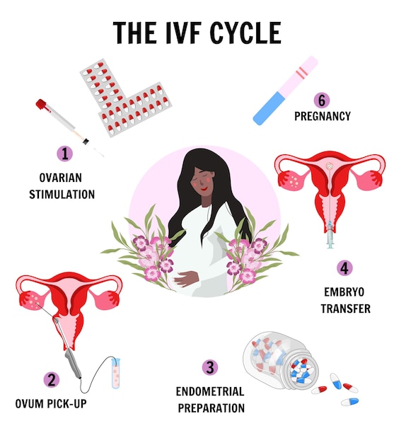 Vector medicina infografía fertilización ginecología y proceso de fertilización in vitro en vector