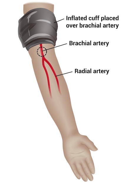 Vector medición de la presión arterial