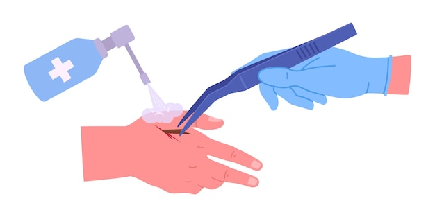 El médico saca la astilla Cartoon de primeros auxilios para el trauma de la piel del cuerpo tratamiento médico para la lesión del brazo ilustración de vector plano mano humana herida y tratamiento médico