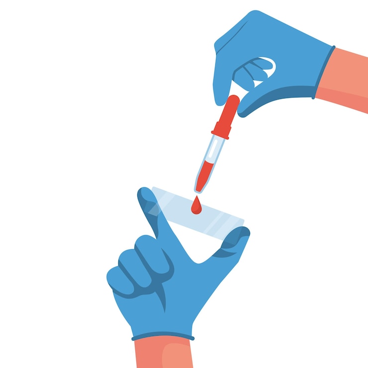 Vector médico con sangre de ensayo en la mano en una diapositiva de vidrio análisis de laboratorio de sangre modelo médico