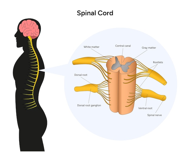 Médula espinal masculina y sección transversal de la médula espinal infográfica en vector
