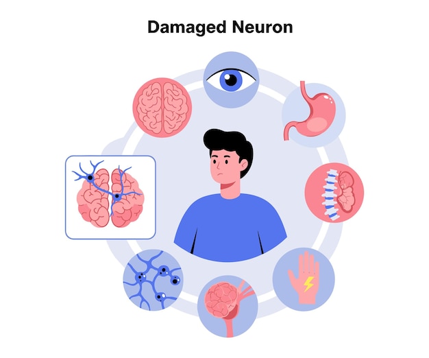 Minimalist Vector Illustration of a Damaged Neuron and Its Effects on the Body