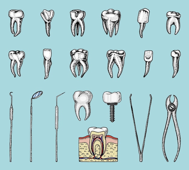 Molar dientes esmalte conjunto dental instrumentos equipo del dentista médico cavidad oral salud limpia o enferma o caries mano grabada humana dibujada en medicina antigua o boceto cuidado para implante de cavidad