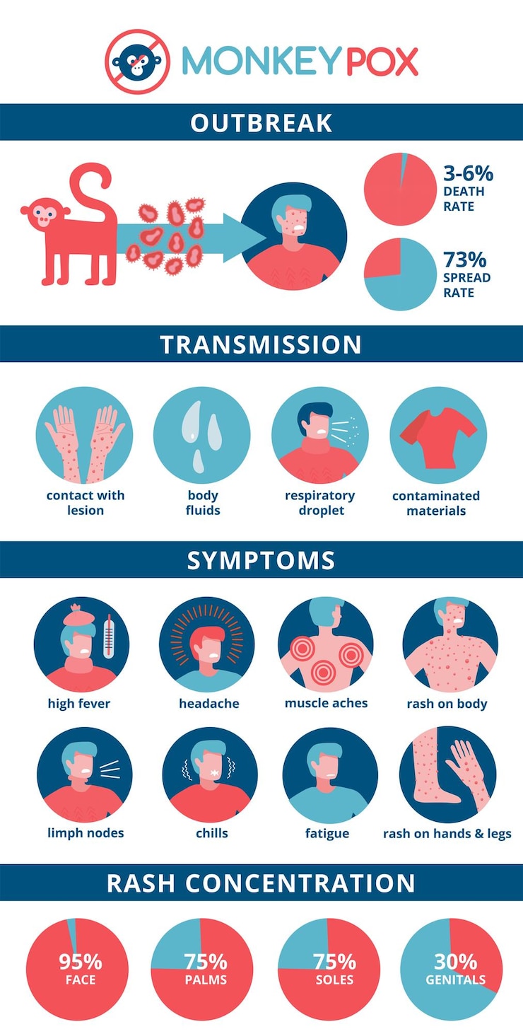 Vector monkeypox virus infografía detallada síntomas transmisión erupción concentración tasa brote iconos i
