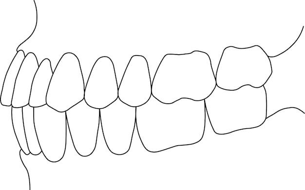 Vector mordida dental