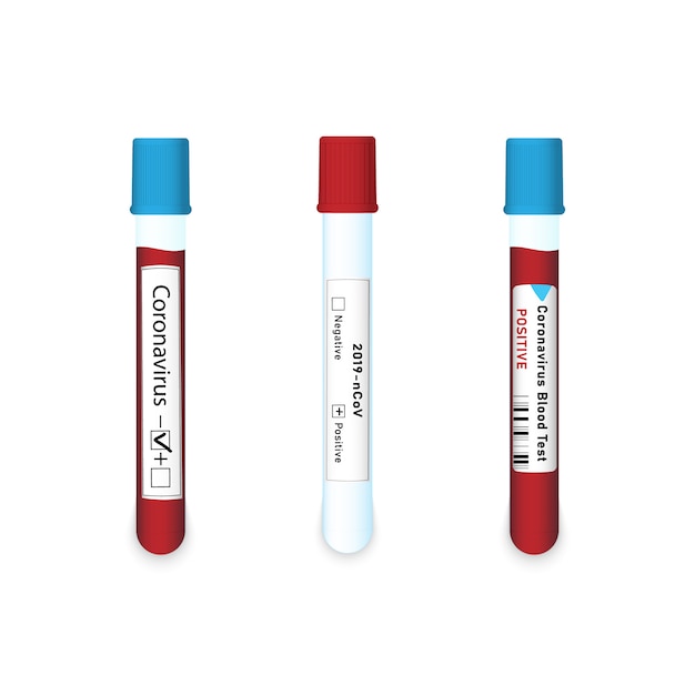 Muestra de sangre coronavirus 2019-ncov.