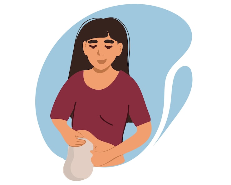Vector una mujer con una bolsa de colostomía ilustración vectorial